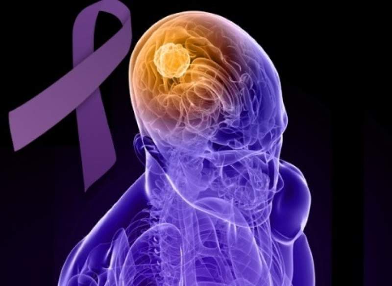 img - 26 Martie - Ziua Mondială a Epilepsiei